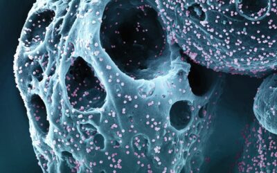 Understanding Bone Density & Osteoporosis: What You Need to Know